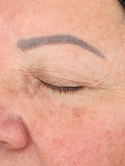 Close up of face before using product